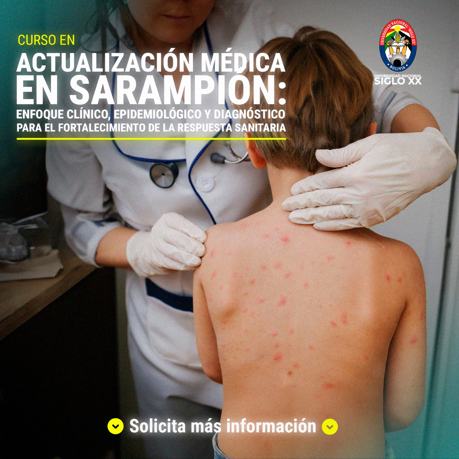 Esam Cursos ACTUALIZACIÓN MÉDICA EN SARAMPIÓN: ENFOQUE CLÍNICO, EPIDEMIOLÓGICO Y DIAGNÓSTICO PARA EL FORTALECIMIENTO DE LA RESPUESTA SANITARIA